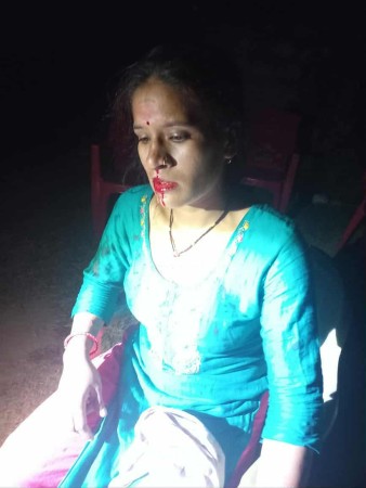 दैलेखमा जातीय विभेदको कलङ्क : पानी छोएको निहुँमा महिलामाथि निर्मम कुटपिट